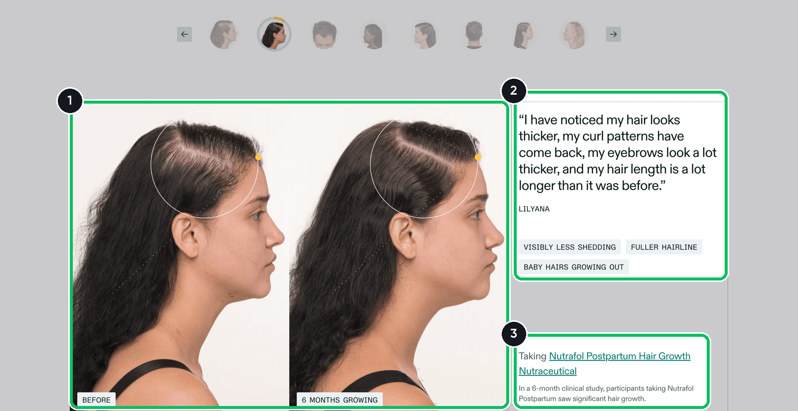 Nutrafol homepage carousel slide with two profile photos of one customer labeled Before and 6 Months Growing